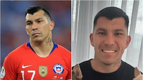 Gary Medel estrenó un nuevo look tras una larga cirugía de al menos 6 horas