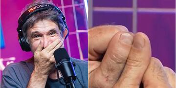 Pancho Melo contó en el El Sentido del Humor cómo perdió parte de su pulgar