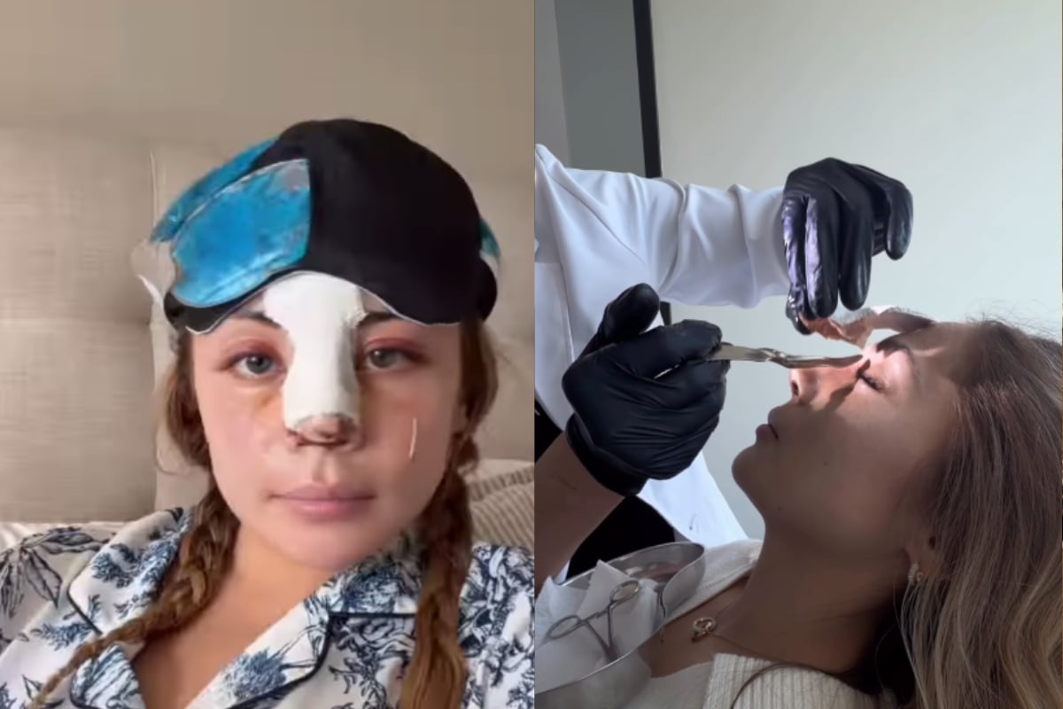 Skarleth Labra mostró su antes y después tras someterse a operación estética