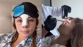 Skarleth Labra mostró su antes y después tras someterse a operación estética