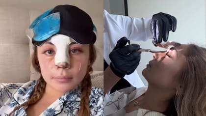 Skarleth Labra mostró su antes y después tras someterse a operación estética