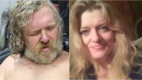 La atacaron con un machete, cayó en coma y despertó luego de dos años: su propio hermano había sido el culpable