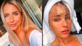 El golpe que sufrió la ex chica reality Angela Duarte en gimnasio peruano: "Estaba haciendo rutina de abdominales y de la nada cae una estructura muy pesada en mi frente. Me hizo perder mucha sangre y también la consciencia..."