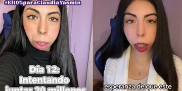 Joven que padece extraño síndrome lanzó campaña para costear prótesis y operación