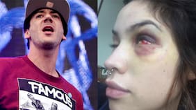 Cantante de Los Tetas formalizado tras golpear a su polola: "Ella se ha autoinflingido heridas"