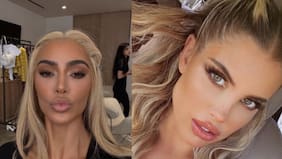 “Demasiado la raja, la usan las Kardashian”: el procedimiento estético al que se sometió Coté López