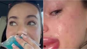 Mujer acabó con el rostro desfigurado tras rellenar sus labios con ácido hialurónico