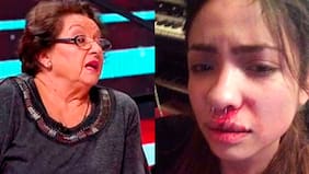 Chilevisión despidió a la doctora Cordero tras criticados dichos sobre joven golpeada por cantante de Los Tetas