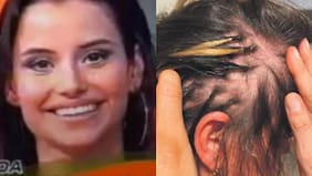 Amanda Cibely, la ex Axé Bahía que lucha contra la alopecia: de Mekano a empresaria