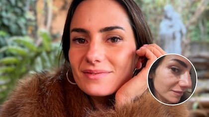 Así reaccionó Rosario Bravo tras ser consultada si se había operado la nariz