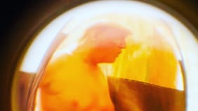 ¿Es o no es? Esta es la verdad de la foto viral de Trump bronceándose