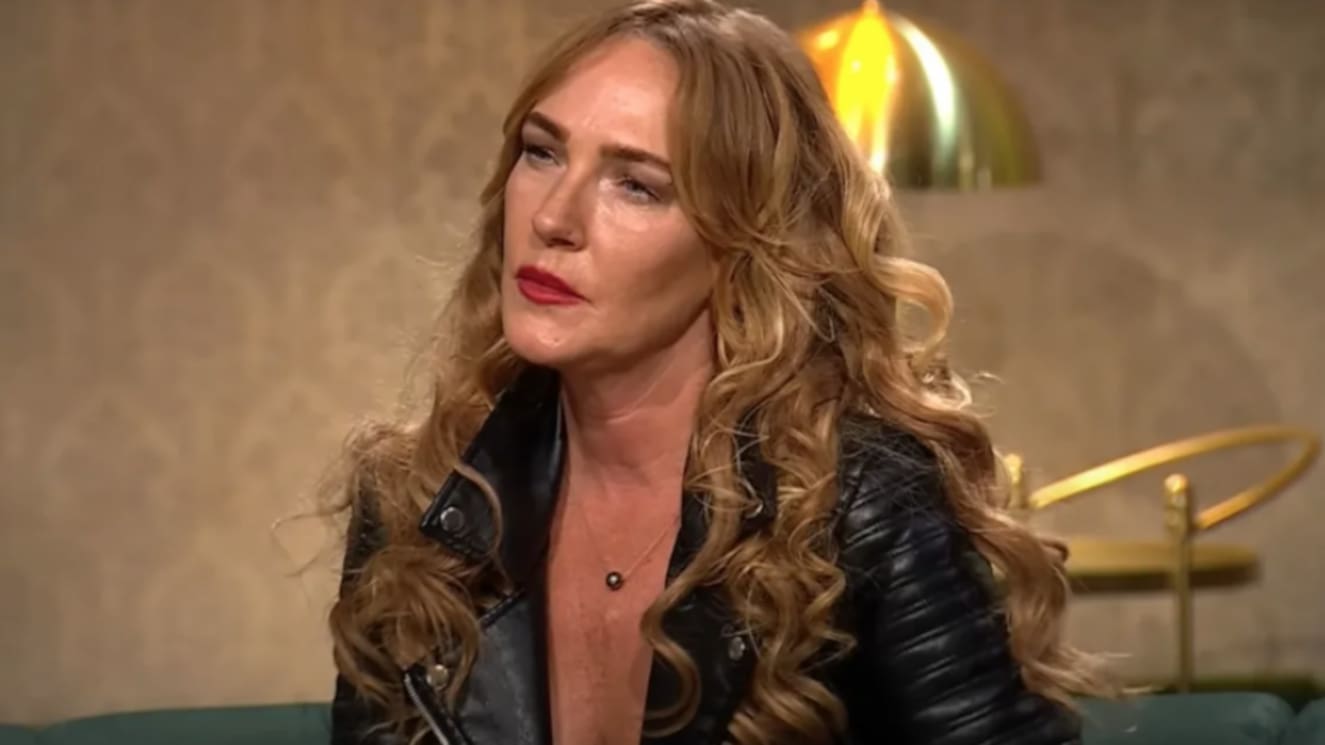 Impacto: el antes y después de Catalina Pulido tras tratamiento estético