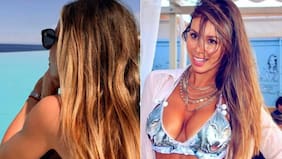 Tras calvario que enfrentó: así luce el rostro de Romina Zalazar a un año de intervención para corregir fallida cirugía