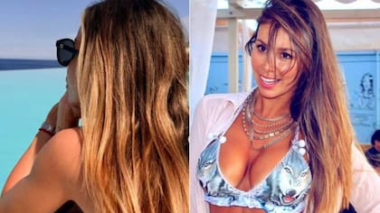 Tras calvario que enfrentó: así luce el rostro de Romina Zalazar a un año de intervención para corregir fallida cirugía