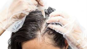 Impactante: teñido de pelo deformó por completo la cabeza de una mujer