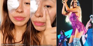fan tuvo mala experiencia en concierto de Karol G luego de que le entrara confeti en el ojo