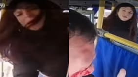 Se registró brutal agresión a chofer en Chillán: mujer trans dejó con heridas a conductor