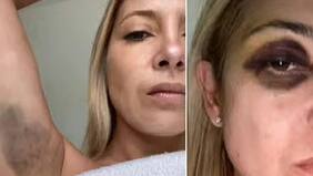 Difunden pruebas de las agresiones del ex presidente de Argentina a su esposa