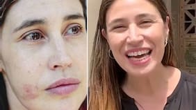 No hay vuelta atrás: María Paz Grandjean celebra decisión judicial contra carabinero que le disparó en el estallido