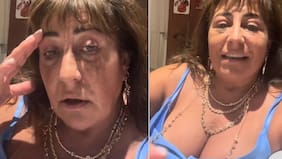 “Miren cómo está…”: Helhue Sukni reveló detalles sobre delicada intervención estética a la que se sometió