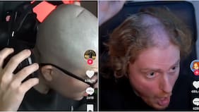 ¡Impactados! Streamers quedan con deformidades en sus cabezas por uso de pesados audífonos