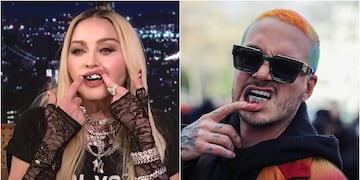 Qué son los grillz tan populares entre los famosos y por qué no son recomendados por los especialistas