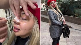 “Todo el mundo me está atacando”: Naya Fácil muestra su “nueva” nariz y responde a lluvia de comentarios