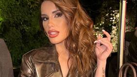 Gala Caldirola sorprendió tras someterse a nueva intervención estética: mostró los resultados de su renovada apariencia