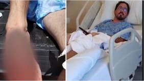 ¡Nuevo ataque de tiburón en Florida! Hombre de 33 años terminó con una arteria perforada y en el hospital