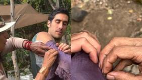 Pedro Astorga sorprendió con exótico tratamiento de salud: “Tratamos de hacerle el menor daño posible”