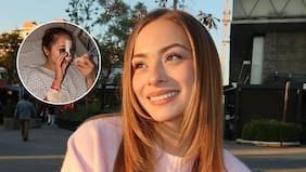 “Para su tranquilidad…”: Skarleth Labra alzó la voz y respondió a las críticas tras someterse a una cirugía estética