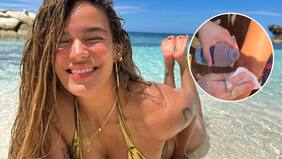 Karol G sufrió estrepitosa caída durante sus vacaciones en Jamaica: mostró registro de las fuertes heridas