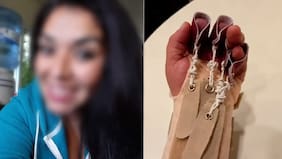 Nueva pesadilla de mujer cuyo vecino le cortó los dedos por negarle beso: salió de la cárcel y le llegó macabro mensaje