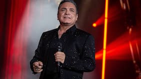 Luis Jara confirma intervención estética y deja a todos marcando ocupado: generó reacciones tras mostrar parte del proceso