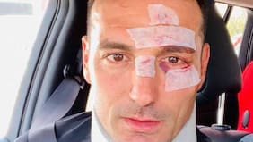 DT de Argentina recibió el alta tras accidente en carretera española