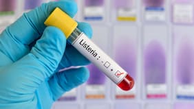 Seremi de Salud emite alerta por presencia de Listeria en queso de cabeza comercializado en la RM