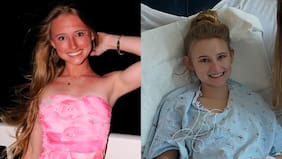 Impacto en redes por muerte de joven influencer que compartió su lucha contra cáncer cerebral: tenía solo 19 años