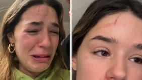 “Hice algo muy estúpido”: Alessia Traverso impacta al aparecer herida tras peligroso “juego”