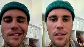 “Recen por mí…”: el preocupante mensaje de Justin Bieber tras sufrir la paralización de su rostro