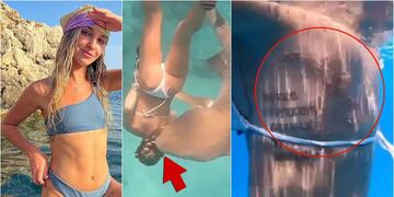 Brutal ataque de tiburón a enfermera