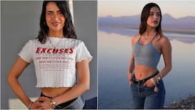 Camilísima reveló íntima “malformación” que descubrió en su adolescencia: le trajo bullying y le repercute hasta hoy