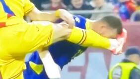 “Maltrecho e irreconocible”: crack europeo muestra cómo le quedó la cara tras sufrir feroz patada