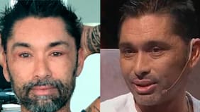 Marcelo "Chino" Ríos reconoce que se hizo la cirugía estética y trata de "vagos cul..." a periodistas