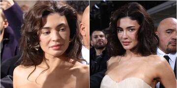 Kylie Jenner fue duramente criticada por su “rostro hinchado” en París: esta es la explicación científica