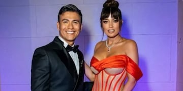 “Hace bien chasconearse un poco”: Américo habló del embrujo de amor que le hizo Yamila Reyna