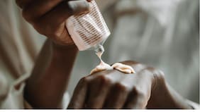 Instituto de Salud Pública emite alerta farmacéutica por defecto en lotes de crema antiacné