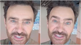 “Jamás me lo hubiese imaginado hace un año”: Jordi Castell mostró los resultados del procedimiento estético al que se sometió