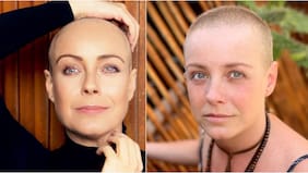 “Quiero que la gente entienda…”: Claudia Conserva reveló por qué decidió mostrar su compleja lucha contra el cáncer