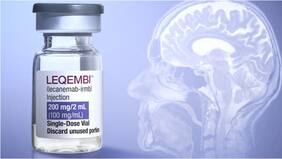 Leqembi: el primer fármaco contra el Alzheimer obtiene la aprobación total de la FDA