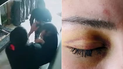 Patada la dejó inconsciente y casi pierde la vista: guía turística golpeada por exjefe revela el robo de su celular